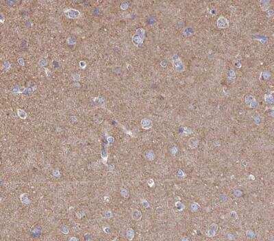 Immunohistochemistry-Paraffin: Clathrin Heavy Chain 1/CHC17 Antibody [NBP2-49293]