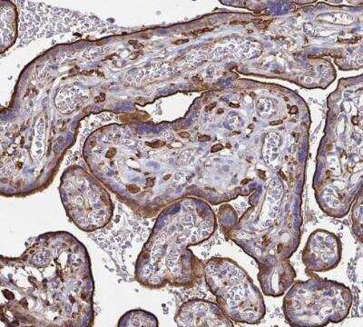 Immunohistochemistry-Paraffin: Clathrin Heavy Chain 1/CHC17 Antibody [NBP2-49293]