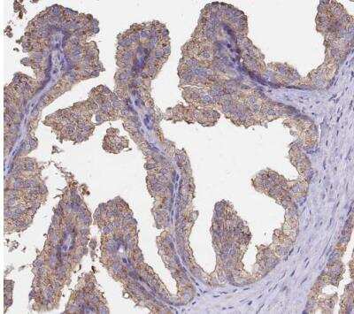 Immunohistochemistry-Paraffin: Clathrin Heavy Chain 1/CHC17 Antibody [NBP2-49293]