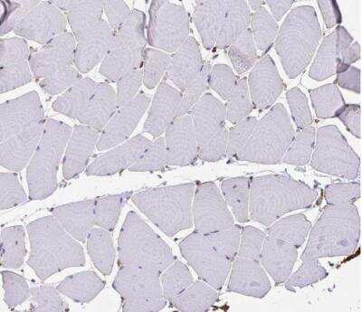 Immunohistochemistry-Paraffin: Clathrin Heavy Chain 1/CHC17 Antibody [NBP2-49293]
