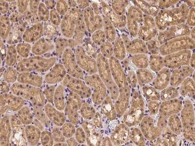 Immunohistochemistry-Paraffin: Clathrin Heavy Chain 1/CHC17 Antibody [NBP2-99308]