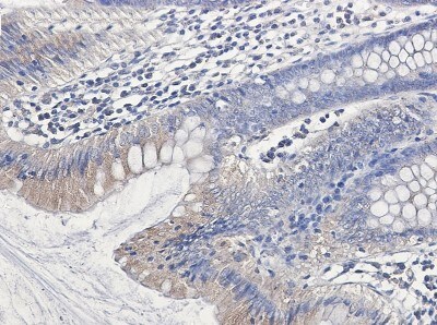 Immunohistochemistry-Paraffin: Clathrin Heavy Chain 1/CHC17 Antibody (S02-6C4) [NBP3-19848]