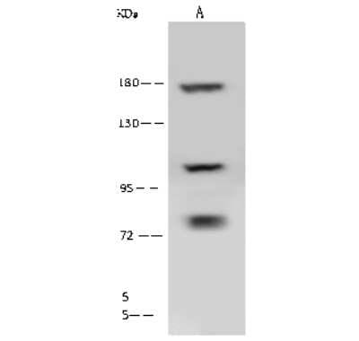 Western Blot: Clathrin Heavy Chain 1/CHC17 Antibody [NBP2-99308]