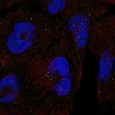Immunocytochemistry/ Immunofluorescence: Clathrin Heavy Chain 2/CHC22/CLTCL1 Antibody [NBP2-56534]