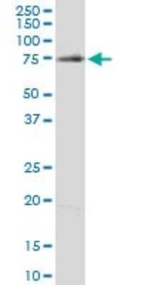 Western Blot: Clathrin interactor 1 Antibody (1E6) [H00009685-M03]