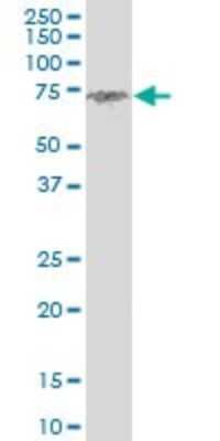 Western Blot: Clathrin interactor 1 Antibody (1E6) [H00009685-M03]