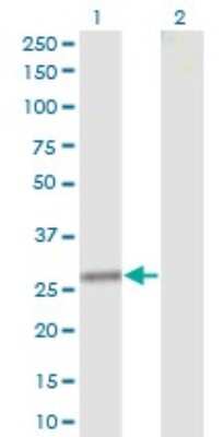 Western Blot: Clathrin light chain Antibody (4D5) [H00001211-M12]