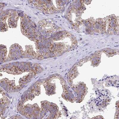 Immunohistochemistry-Paraffin: Clathrin light chain Antibody [NBP2-38638]