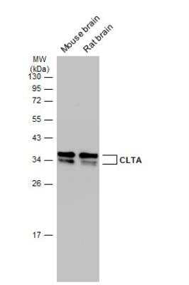 Western Blot: Clathrin light chain Antibody [NBP2-14913]