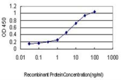 ELISA: Claudin-1 Antibody (1C5-D9) [H00009076-M01]