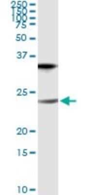 Immunoprecipitation: Claudin-1 Antibody (1C5-D9) [H00009076-M01]