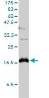 Western Blot: Claudin-1 Antibody (1C5-D9) [H00009076-M01]