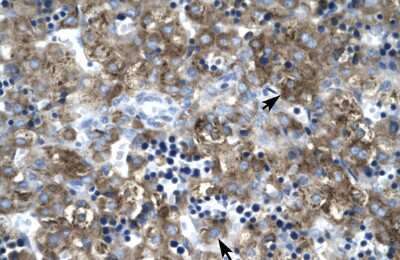 Immunohistochemistry-Paraffin: Claudin-1 Antibody [NBP1-59107]