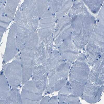Immunohistochemistry-Paraffin: Claudin-11 Antibody [NBP1-82470]