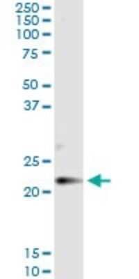 Immunoprecipitation: Claudin-14 Antibody (3D11) [H00023562-M01]