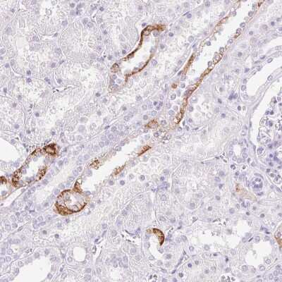 Immunohistochemistry-Paraffin: Claudin-16 Antibody [NBP2-38777]