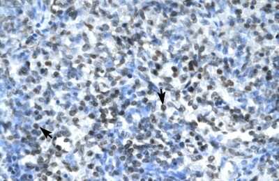Immunohistochemistry-Paraffin: Claudin-17 Antibody [NBP1-59155]