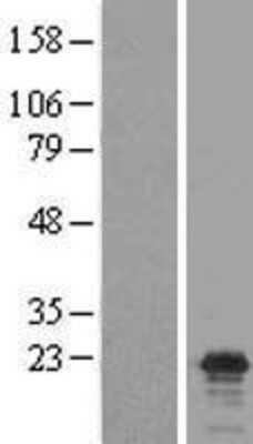 Western Blot: Claudin-17 Overexpression Lysate [NBL1-09242]