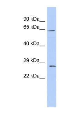 Western Blot: Claudin-18 Antibody [NBP1-59250]