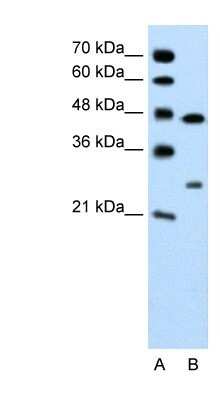 Western Blot: Claudin-18 Antibody [NBP1-60010]