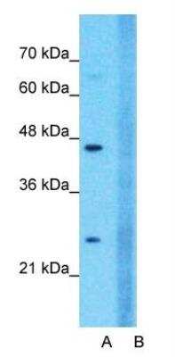 Western Blot: Claudin-18 Antibody [NBP1-60010]