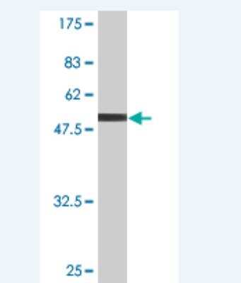 Western Blot: Claudin-19 Antibody (2F2) [H00149461-M02]