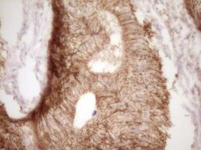 Immunohistochemistry: Claudin-3 Antibody (OTI1E7) [NBP2-46299]