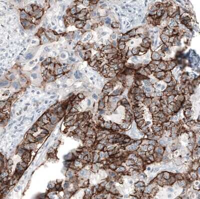 Immunohistochemistry-Paraffin: Claudin-3 Antibody (CL13129) [NBP3-18563]