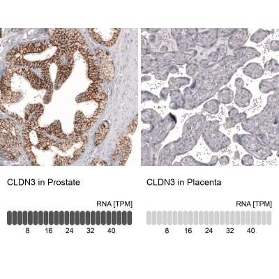 Immunohistochemistry-Paraffin: Claudin-3 Antibody (CL13130) [NBP3-18555]