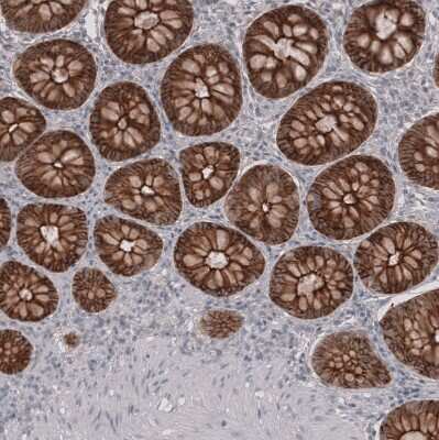 Immunohistochemistry-Paraffin: Claudin-3 Antibody (CL13130) [NBP3-18555]