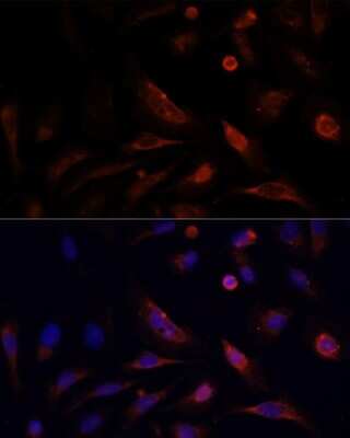 Immunocytochemistry/ Immunofluorescence: Claudin-5 Antibody - Azide and BSA Free [NBP2-92846]