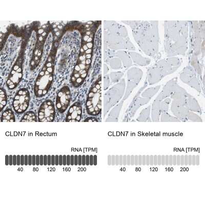 Immunohistochemistry-Paraffin: Claudin-7 Antibody [NBP1-85683]