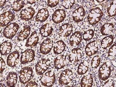 Immunohistochemistry-Paraffin: Claudin-7 Antibody [NBP2-97417]