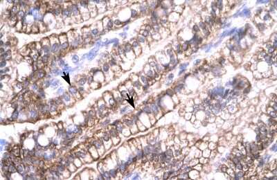 Immunohistochemistry: Claudin-8 Antibody [NBP1-59157]