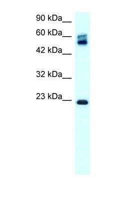 Western Blot: Claudin-8 Antibody [NBP1-59157]