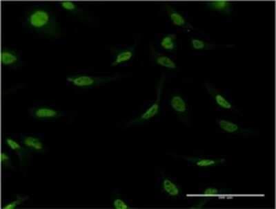Immunocytochemistry/ Immunofluorescence: Cleavage stimulation factor 2 Antibody (4E3-3C9) [H00001478-M02]
