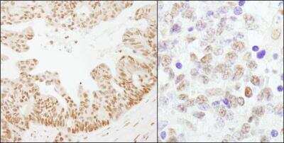 Immunohistochemistry-Paraffin: Cleavage stimulation factor 2 Antibody [NB100-57531]