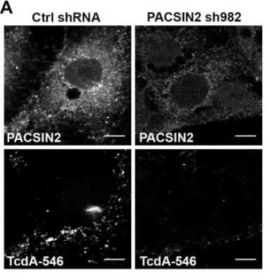 Immunocytochemistry/ Immunofluorescence: Clostridium Difficile Toxin A Antibody (PCG4.1) - BSA Free [NB600-1066]