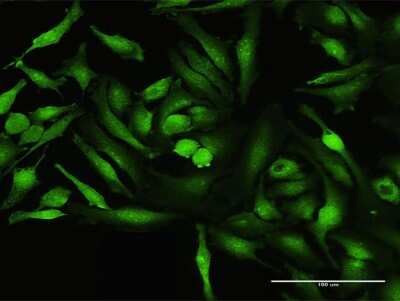 Immunocytochemistry/ Immunofluorescence: CoCoA Antibody [H00057658-B01P]