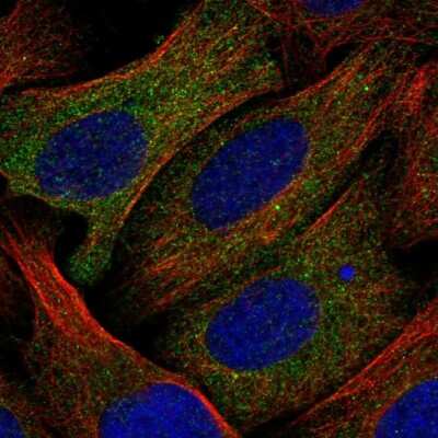 Immunocytochemistry/ Immunofluorescence: CoCoA Antibody [NBP1-88215]