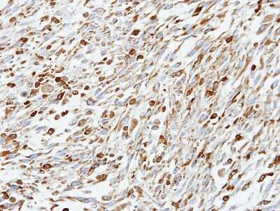 Immunohistochemistry-Paraffin: CoCoA Antibody [NBP1-32154]