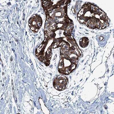 Immunohistochemistry-Paraffin: CoCoA Antibody [NBP1-88215]