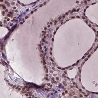 Immunohistochemistry-Paraffin: CoREST3/RCOR3 Antibody [NBP2-68930]