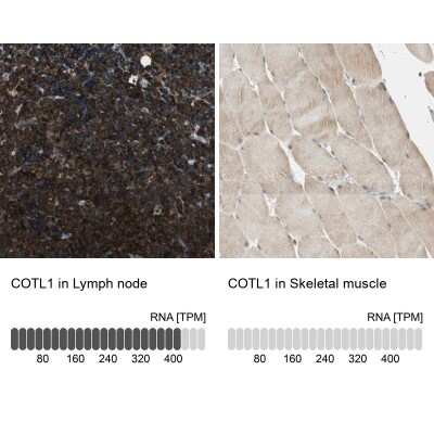 Immunohistochemistry-Paraffin: Coactosin-like Protein 1/CotL1 Antibody [NBP2-48515]