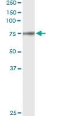 Immunoprecipitation: Coagulation Factor II/Thrombin Antibody (1B7) [H00002147-M01]