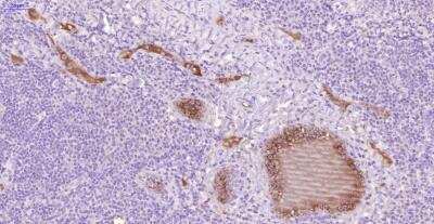 Immunohistochemistry: Thrombin-antithrombin (TAT) complexes Antibody (22) - BSA Free [NBP2-41381]