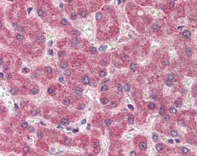 Immunohistochemistry: Coagulation Factor II/Thrombin Antibody [NBP1-58268]