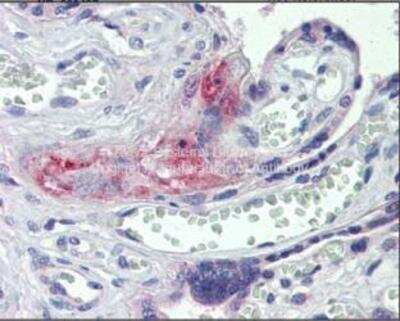 Immunohistochemistry-Paraffin: Coagulation Factor II/Thrombin Antibody [NBP1-58268]