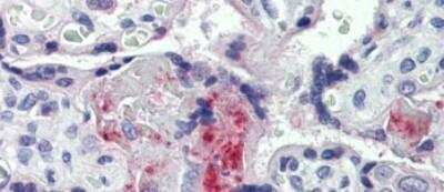 Immunohistochemistry-Paraffin: Coagulation Factor II/Thrombin Antibody [NBP1-58268]