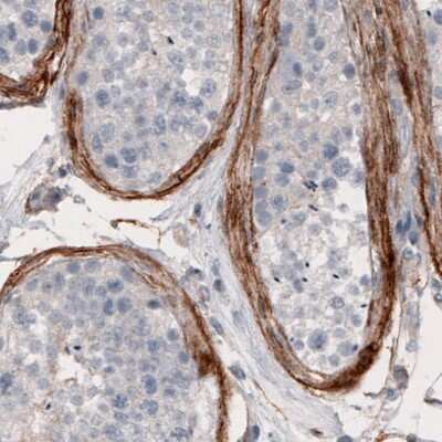 Immunohistochemistry: Coagulation Factor III/Tissue Factor Antibody (CL3805) [NBP2-61640]